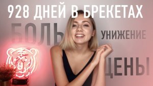 Жизнь с брекетами: сколько стоит, как выбрать врача и чего ждать
