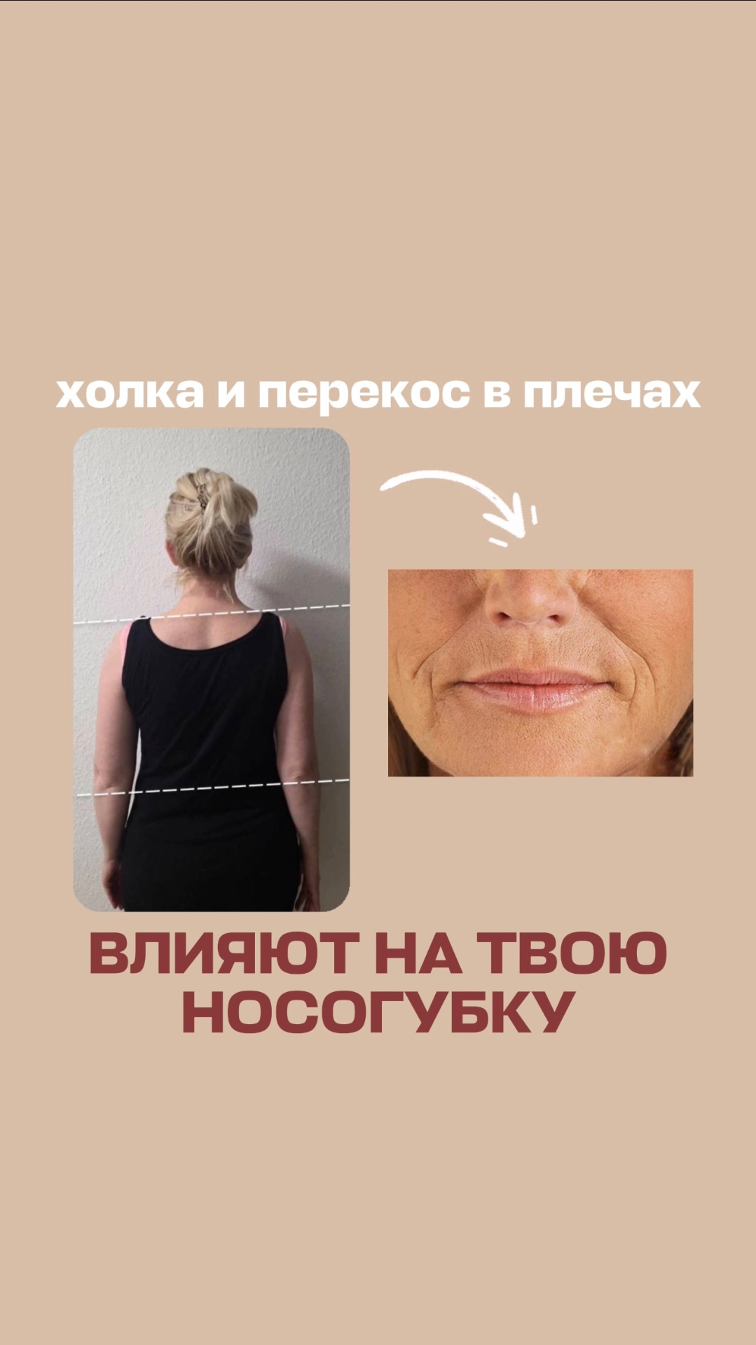 Это влияет на твою носогубку