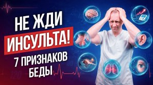СРОЧНО ПРОВЕРЬ У СЕБЯ! Как понять, что у вас гипертония? Советы доктора Шишонина.