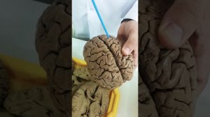 Общее строение головного мозга. Извилины и борозды.