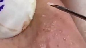Советы по очищению и уходу за лицом