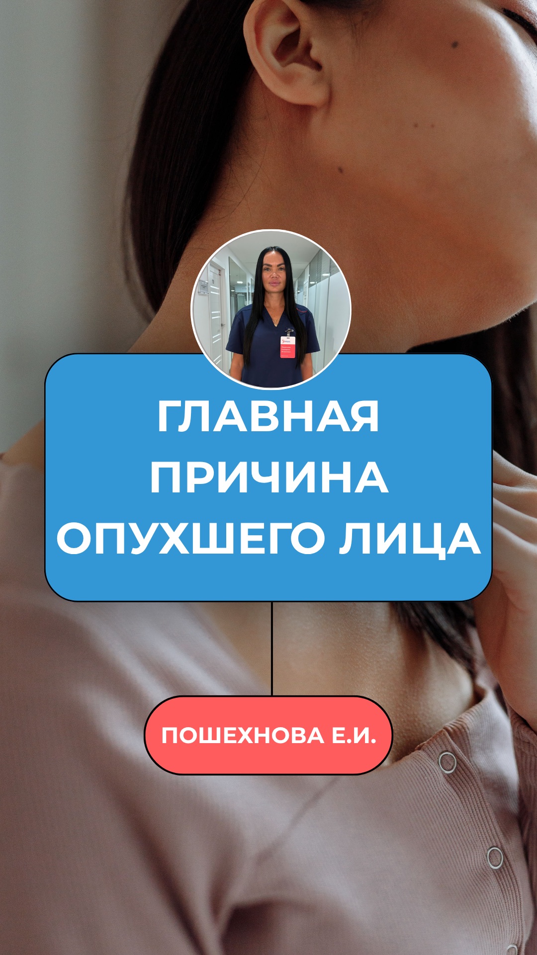 Просыпаешься с опухшим лицом. Мешки, тяжёлые веки, овал расплылся, второй подбородок.