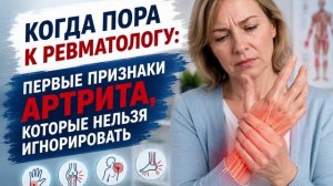 Когда пора обращаться к ревматологу и какие симптомы артрита нельзя игнорировать?