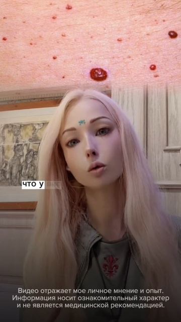 Многие видят красные точки на теле И просто не обращают внимания