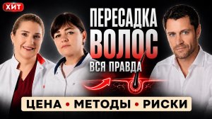 Пересадка волос: цена, методы, риски и правда о лечении облысения. Трихолог раскрывает правду