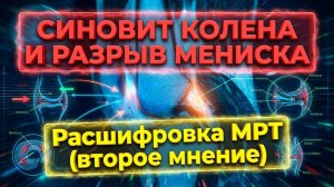 СИНОВИТ коленного сустава, КИСТА Бейкера и РАЗРЫВ МЕНИСКА на РАСШИФРОВКЕ МРТ коленного сустава