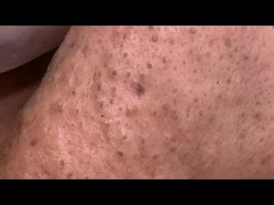Глубокое очищение пор и удаление черных точек: ASMR спа-уход!