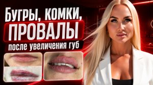 Бугры, комки, провалы после увеличения губ