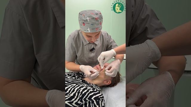 Дневник пациентки Екатерины - 4-е сутки после комплексного омоложения лица.