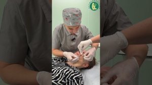 Дневник пациентки Екатерины - 4-е сутки после комплексного омоложения лица.