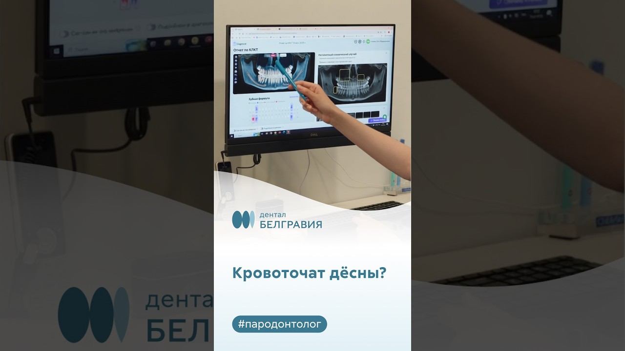 Кровоточат десны? Первый звоночек, который нельзя пропускать!