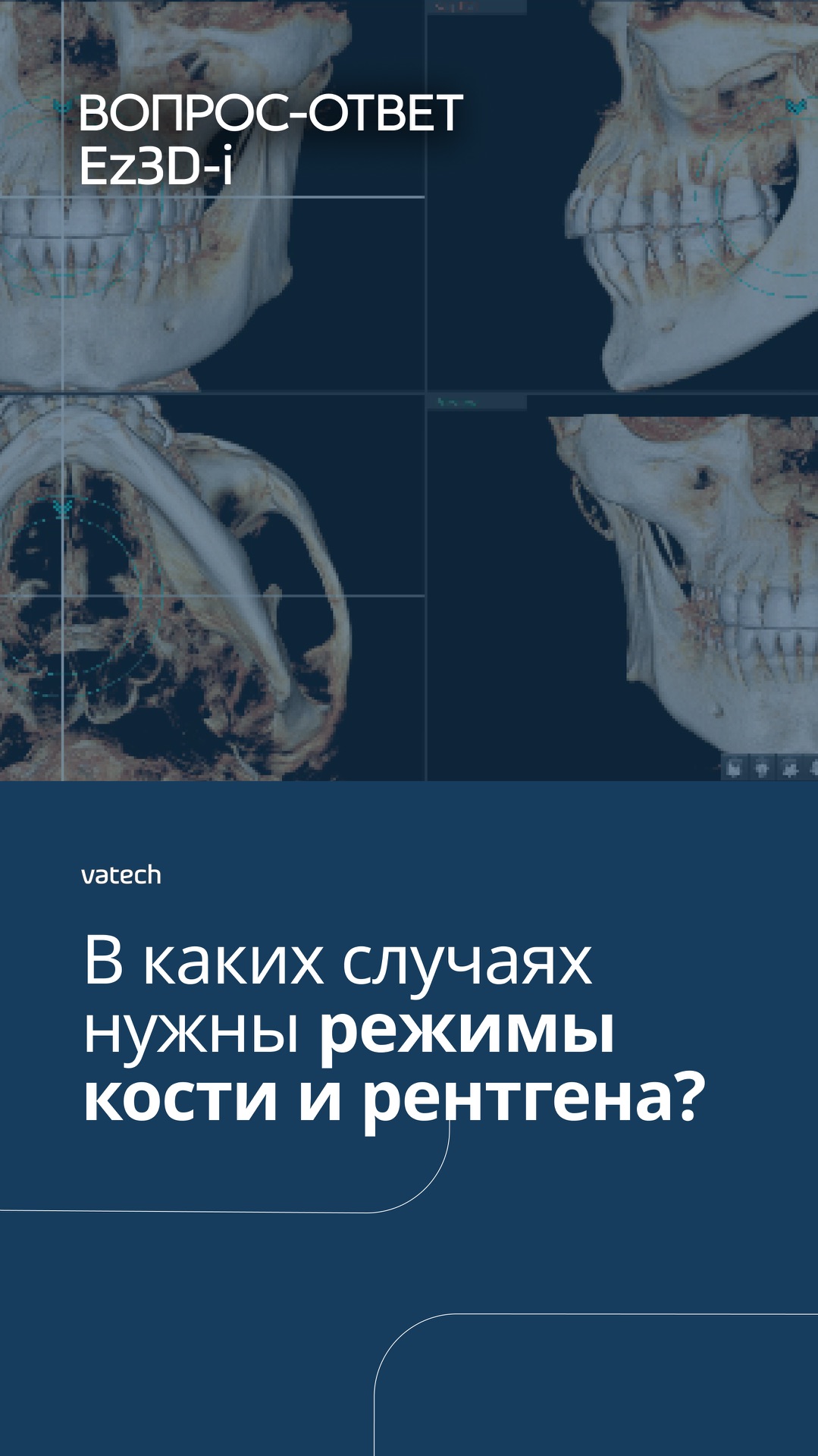 В каких случаях нужны режимы кости и рентгена?