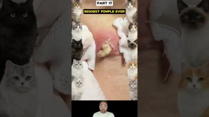 Вау! Угревая сыпь #pimple #pimplepopper #pimples #blackheads (Часть 17)