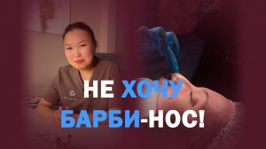 Убрали горбинку и укоротили нос: результат через месяц