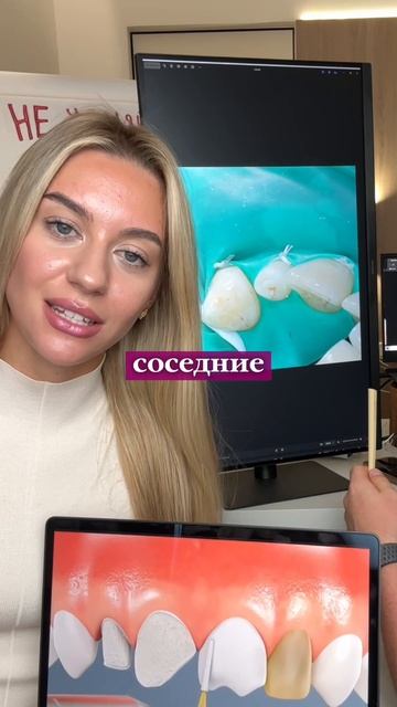 Не спеши стачивать зубы под виниры