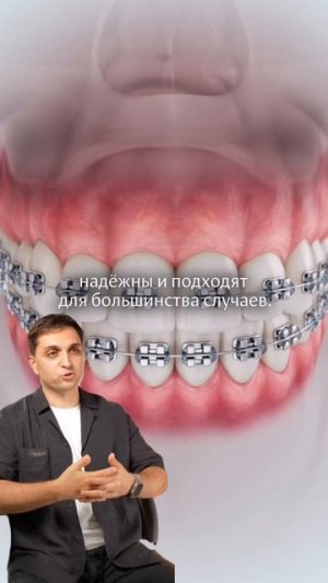 Как работают брекеты