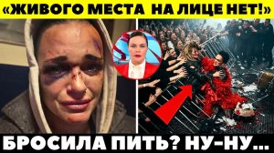 ПОЗОРИЩЕ ГОДА! Пьяная в хлам Слава устроила КРОВАВОЕ ПОБОИЩЕ на сцене!