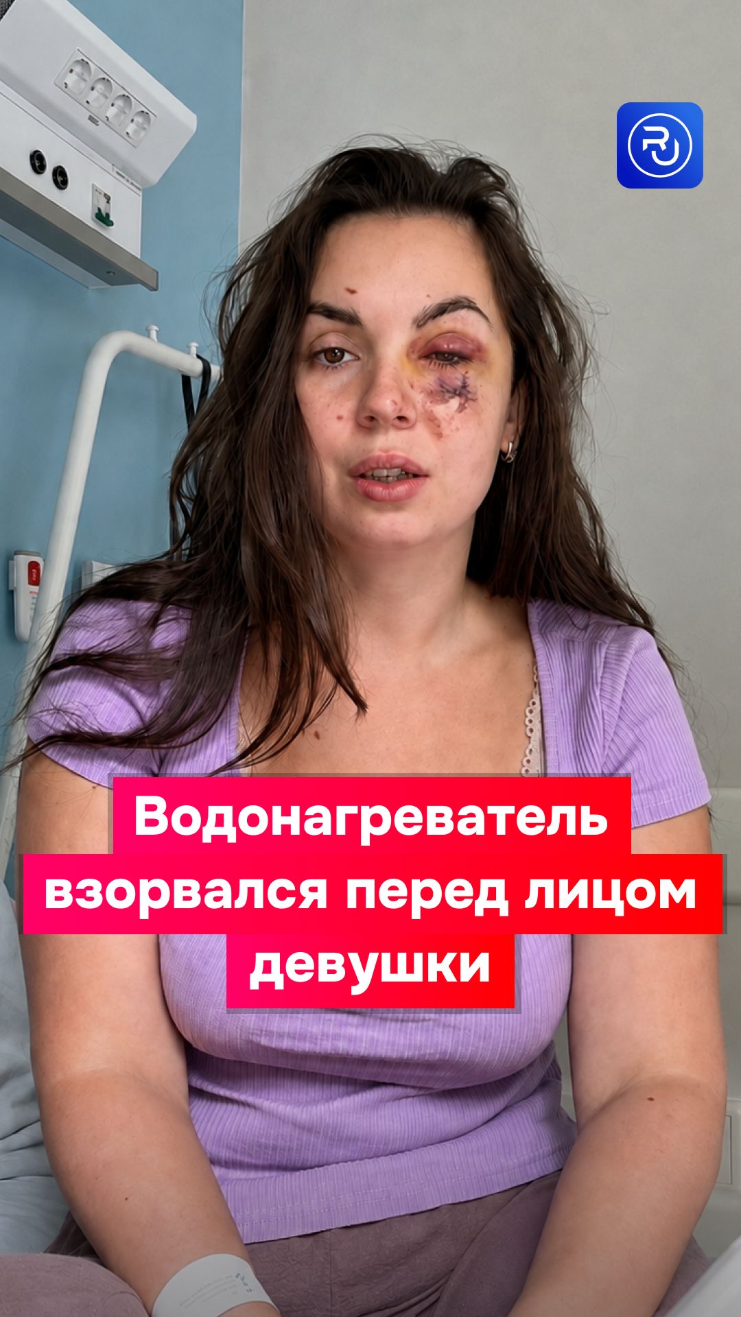 Водонагреватель взорвался перед лицом девушки