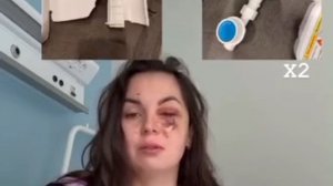 😱 Водонагреватель взорвался прямо перед лицом девушки в душе — она потеряла зрение на один глаз