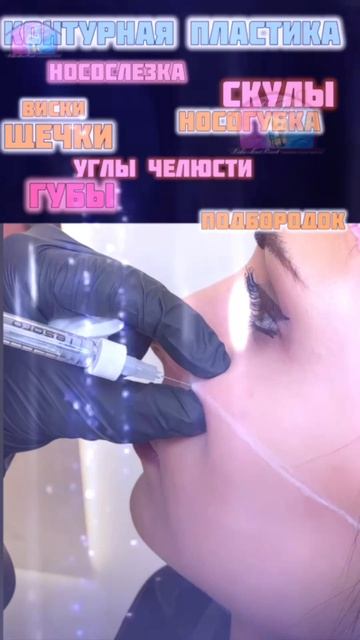 контурная пластика : губы, скулы, подбородок, углы челюсти, щечки яблочки, профиль Джоли, носогубка,