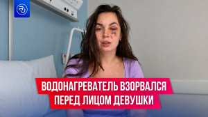 Водонагреватель взорвался перед лицом девушки