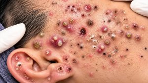 Расслабляющий уход за кожей: очищение для спокойствия