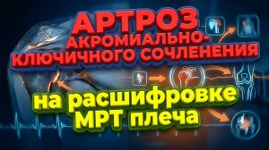 АРТРОЗ акромиально-ключичного сочленения, РАЗРЫВ суставной губы на РАСШИФРОВКЕ МРТ плечевого сустава