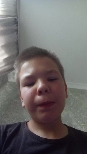 67