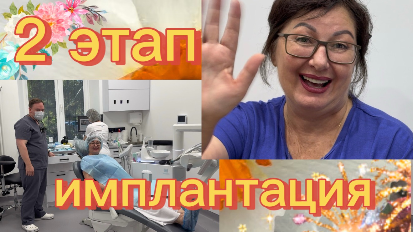 ИМПЛАНТАЦИЯ 🦷 2 ЭТАП 🦷 Мой путь к новой улыбке 😃 Моя радость ❤️