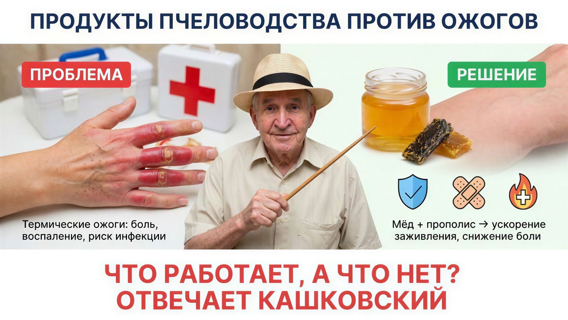 🍯 Лечение ожогов прополисом и мёдом: что советует профессор Кашковский 🐝🩹