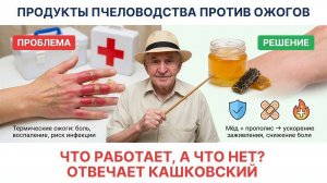 🍯 Лечение ожогов прополисом и мёдом: что советует профессор Кашковский 🐝🩹