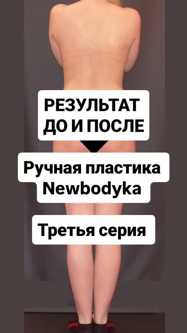 РЕЗУЛЬТАТ ДО И ПОСЛЕ. Ручная пластика тела NewBodyKa.Третья серия
