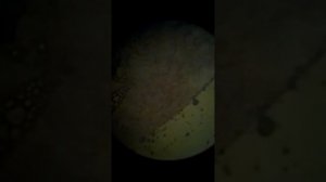 Микроскопия кишечника больной рыбы
