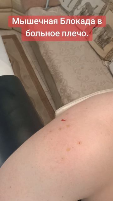 Мышечная Блокада в больное плечо. Избавление от любых видов боли. #обучениемассажу #костоправмосква