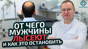 Как реально остановить выпадение волос у мужчин