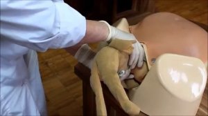 Классическое ручное пособие при тазовом предлежании (осложнения)