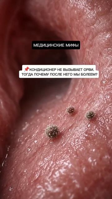 Заболел после кондиционера :
