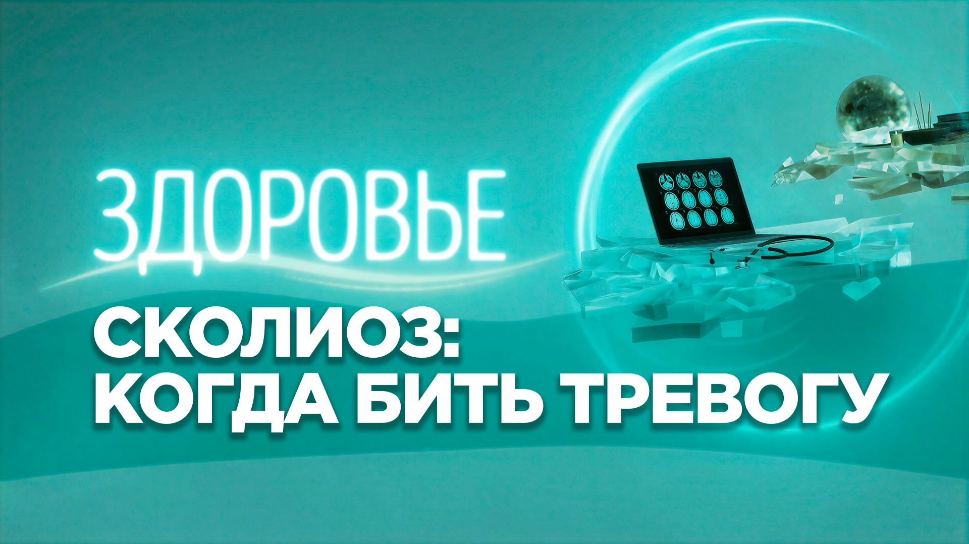Сколиоз | Почему болит спина?
