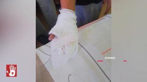 Две 7-летние девочки получили мощный удар током в Коркино