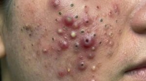 Верните сияние и спокойствие через осознанный уход за кожей