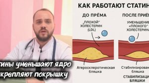 Статины: почему их не нужно бояться и принимать пожизненно