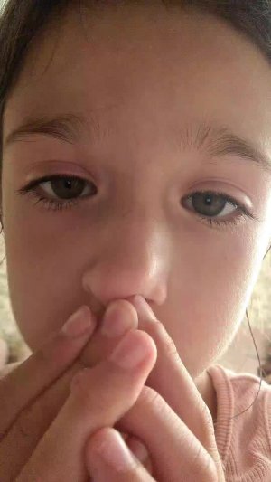 орвдрв