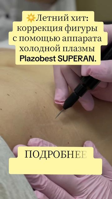 ☀️Летний хит: коррекция фигуры с помощью аппарата холодной плазмы Plazobest SUPERAN.