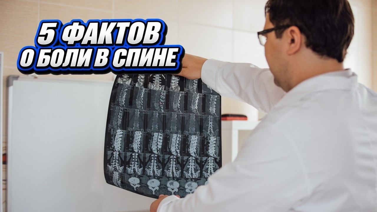 5 фактов о боли в спине, которые вас удивят