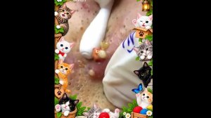 Вау! 😱 Чёрные точки (Часть 21)