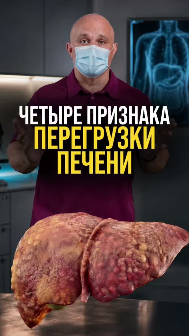 Четыре признака перегрузки печени