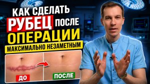РУБЕЦ после операции будет НЕЗАМЕТНЫМ! Как правильно заботиться о шрамах после операции