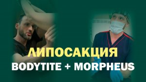 Почему кожа не подтягивается сразу после липосакции? Результат на 3-и сутки