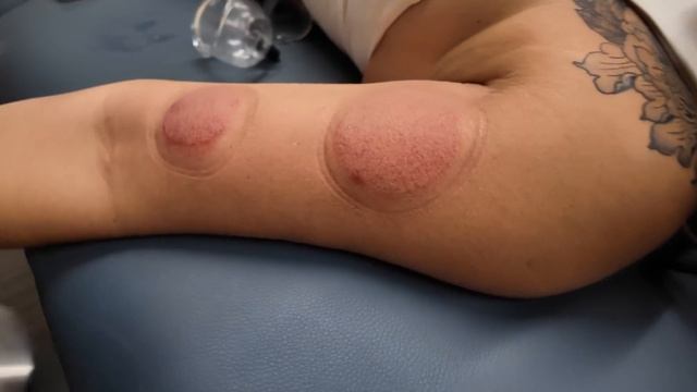Her Release Got REALLY INTENSE! She Was Ready To Throw Fist  Bodywork Massage Therapy