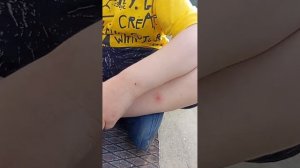 опрос как хорошо быть эндерменом